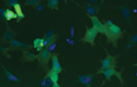 Fluorescent reporter for proteasome activity